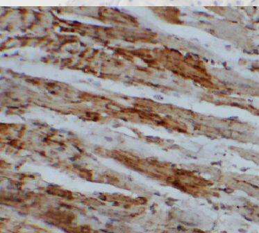 archaemetzincin-1 Antibody - BSA Free