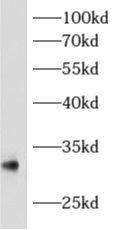 archaemetzincin-1 Antibody - BSA Free