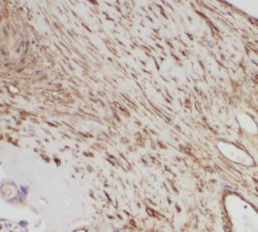 PRKAG2 Antibody - BSA Free