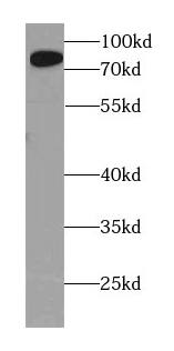 AMPD1 Antibody - BSA Free