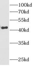 AMMECR1 Antibody - BSA Free