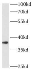 CART1 Antibody - BSA Free