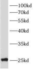 ALKBH7 Antibody - BSA Free