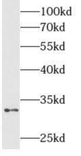 ALKBH4 Antibody - BSA Free
