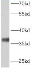 ALG5 Antibody - BSA Free