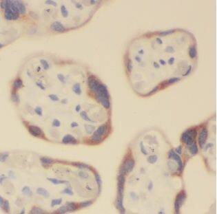 ALG5 Antibody - BSA Free