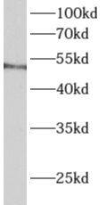 ALDH3B1 Antibody - BSA Free