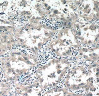 ALDH3B1 Antibody - BSA Free