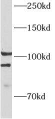 ALDH1L2 Antibody - BSA Free
