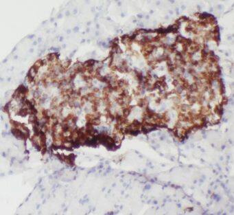 ALDH1L2 Antibody - BSA Free