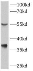 AKR7A3 Antibody - BSA Free