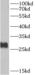 AKAP14 Antibody - BSA Free