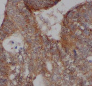 AKAP1 Antibody - BSA Free