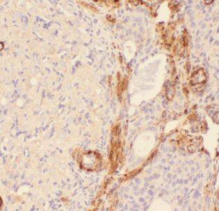 AIG1 Antibody - BSA Free