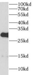 AIG1 Antibody - BSA Free