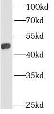 AGPAT9 Antibody - BSA Free