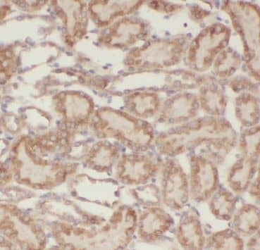 AGPAT9 Antibody - BSA Free