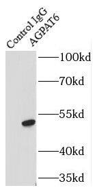 AGPAT6 Antibody - BSA Free