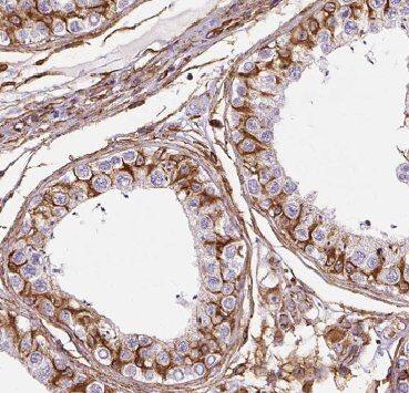 AGPAT6 Antibody - BSA Free