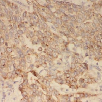CBCP3 Antibody - BSA Free