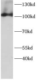 Advillin Antibody - BSA Free
