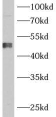 ADHFE1 Antibody - BSA Free