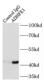 ADHFE1 Antibody - BSA Free