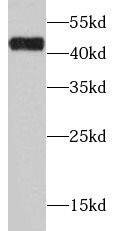 alcohol dehydrogenase 1C Antibody - BSA Free