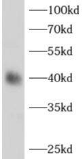 alcohol dehydrogenase 1B Antibody - BSA Free