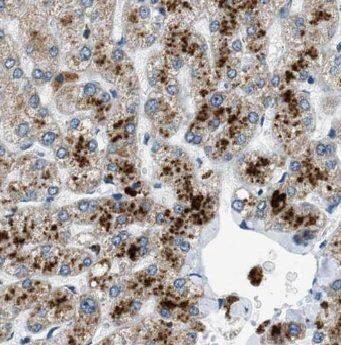 ADAT2 Antibody - BSA Free