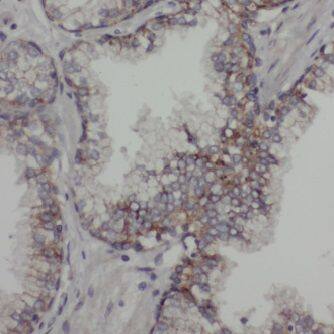 ACTL7B Antibody - BSA Free