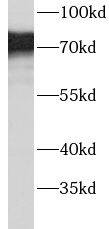 ACSS1 Antibody - BSA Free