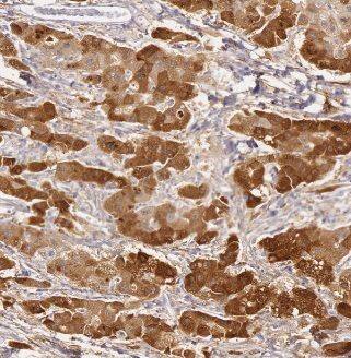 ACSM5 Antibody - BSA Free