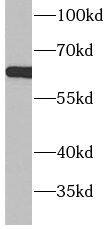ACSM5 Antibody - BSA Free