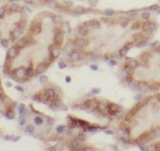 ACSM3 Antibody - BSA Free