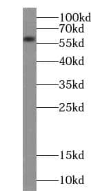 ACSM3 Antibody - BSA Free