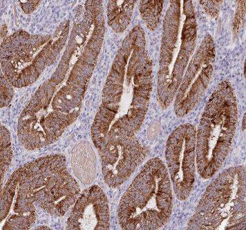 ACSF2 Antibody - BSA Free
