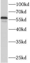 ACSF2 Antibody - BSA Free