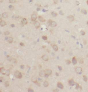 ACOT7 Antibody - BSA Free
