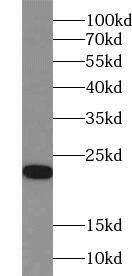 ACOT6 Antibody - BSA Free