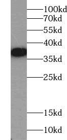 ACBD4 Antibody - BSA Free