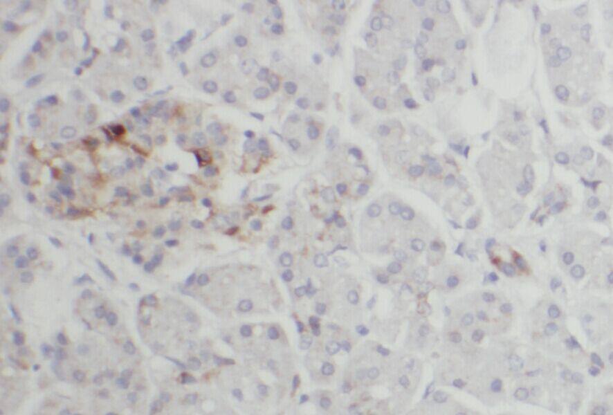 ACAD10 Antibody - BSA Free