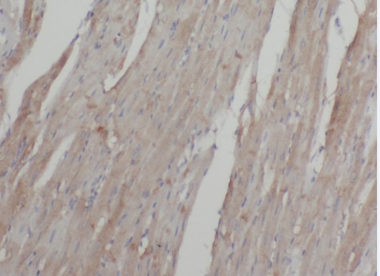 ABLIM2 Antibody - BSA Free