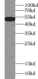 ABHD15 Antibody - BSA Free