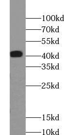 ABHD12B Antibody - BSA Free