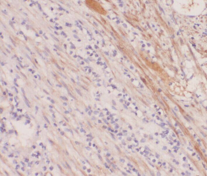 ABHD12B Antibody - BSA Free