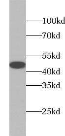 ABHD1 Antibody - BSA Free