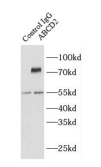 ABCD2 Antibody - BSA Free