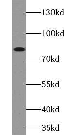 ABCB7 Antibody - BSA Free