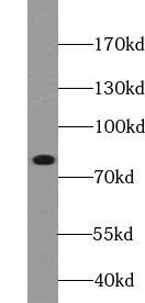 ABCB10 Antibody - BSA Free